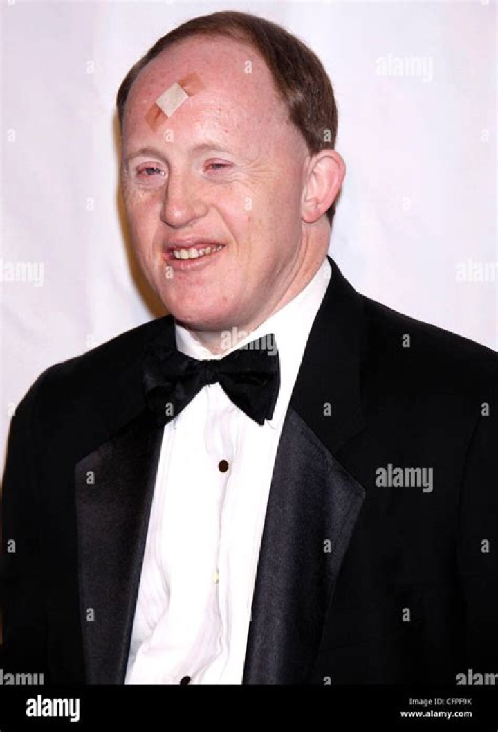 Remembering Chris Burke: A Tribute To His Life And Legacy