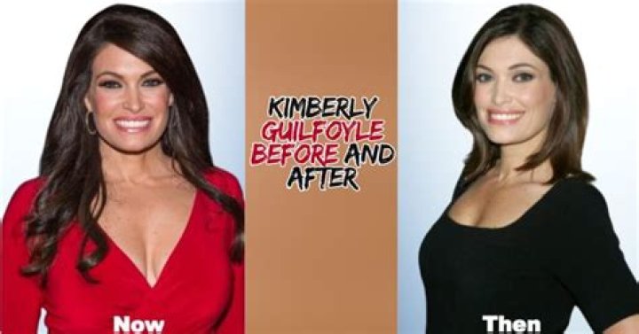 Transformations In The Spotlight: Kimberly Guilfoyle Before And After