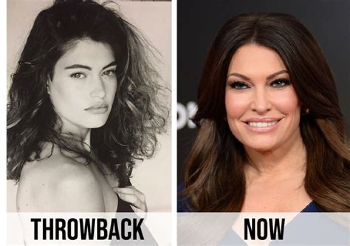 Unveiling The Transformation: Kimberly Guilfoyle's Face Before And After